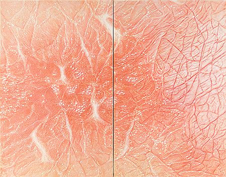 OHNE TITEL (DIPTYCHON)