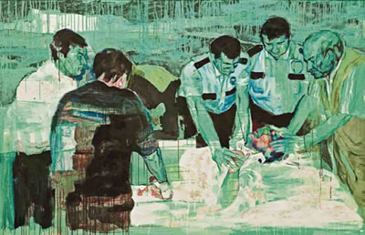 Circumcision