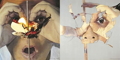 Watching the wound (2 panels)