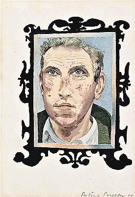 Portrait of Patrick Procktor: Myxomatosis (Self-Portrait in a mirror)