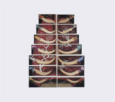 Xylophone-I (14 parts)