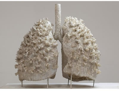 BREATHING SYSTEM - LUNGS
