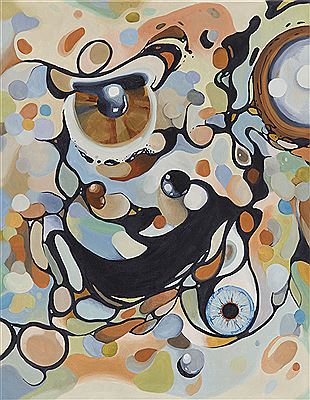 Cataract